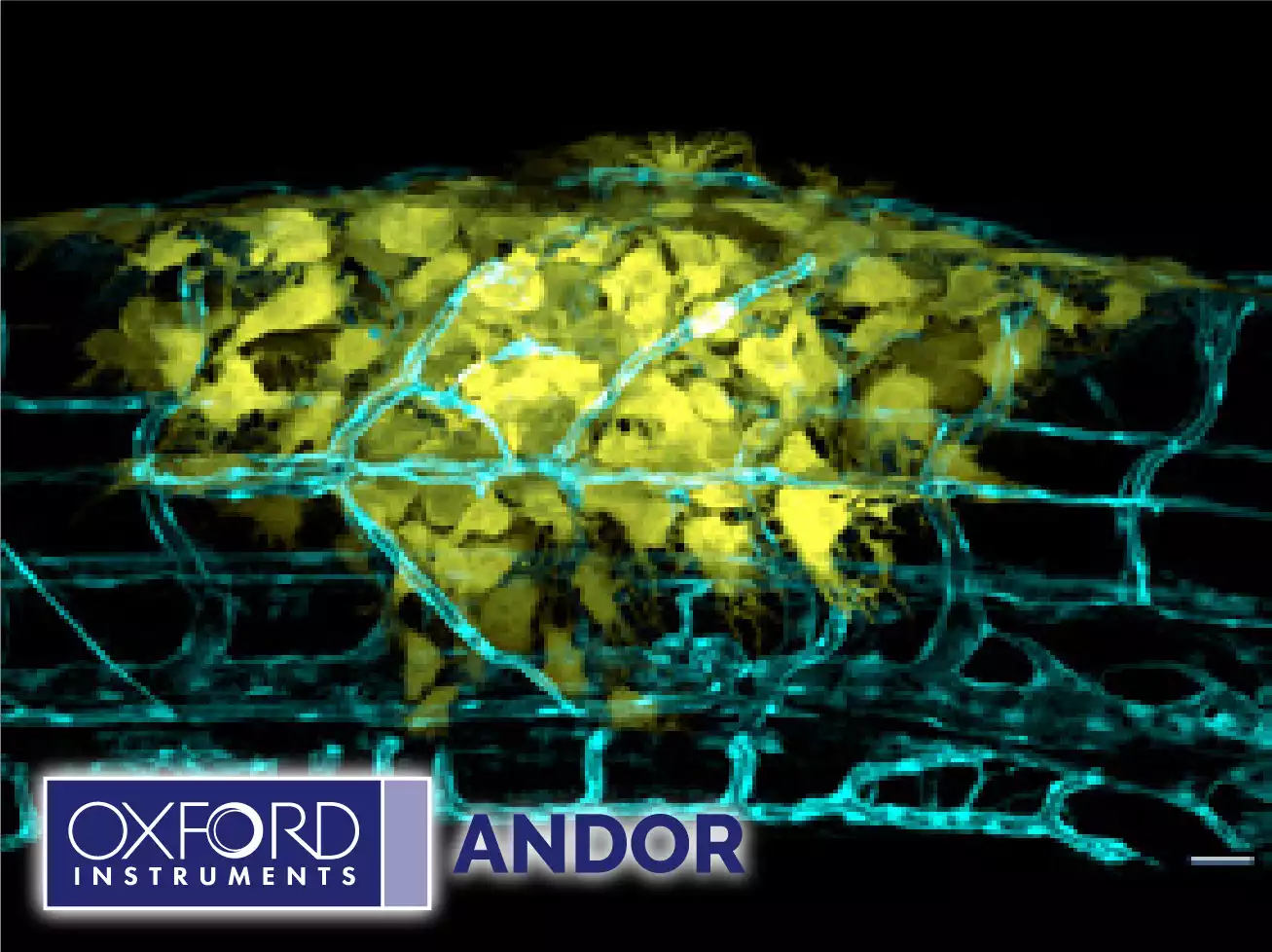 Andor High-Speed Confocal with 3D Super-Resolution